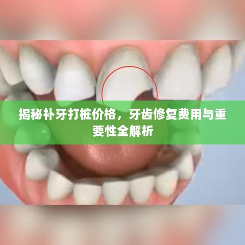 揭秘补牙打桩价格，牙齿修复费用与重要性全解析