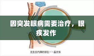 因突发眼病需要治疗，眼疾发作 