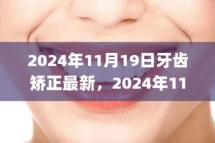 2024年11月19日，牙齿矫正最新进展，自信笑容的蜕变之旅